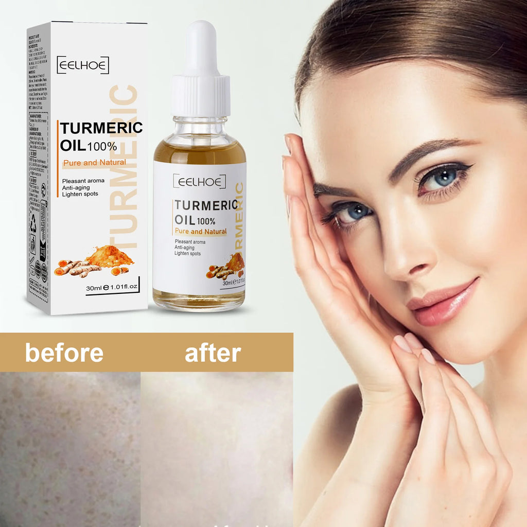 Eelhoe Turmeric Face Serum – Brightening & Dark Spot Essence Brightening Face Serum QXL