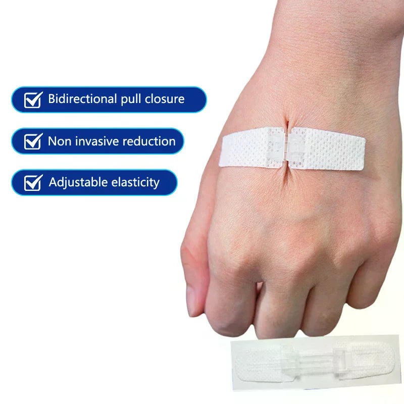 Zipper Wound Closure Patch | Suture-Free Emergency Bandage Wound Closure Patch QXL