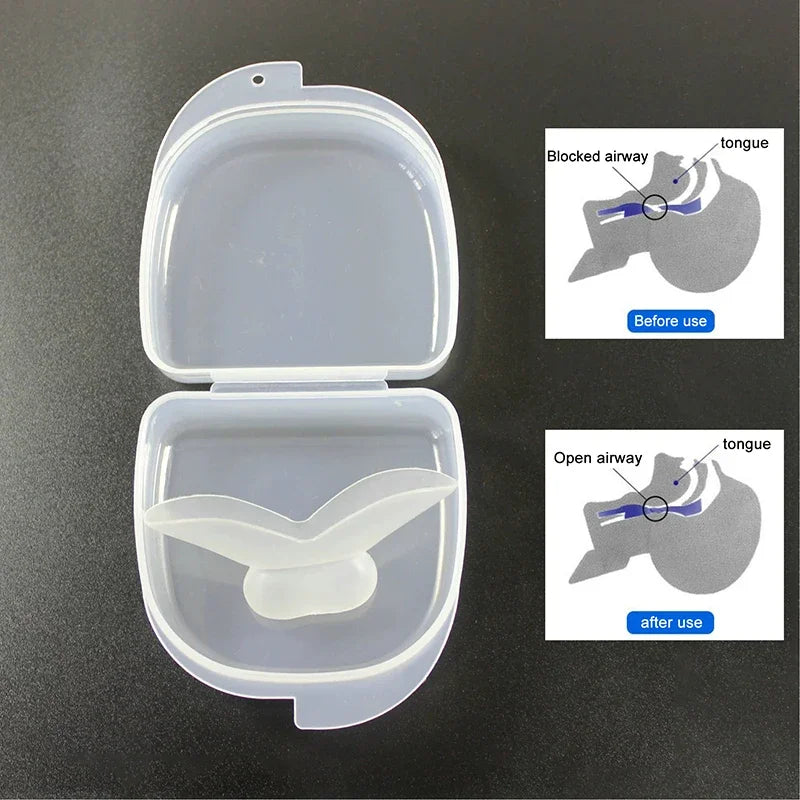 Silicone Tongue Stabilizing Mouthpiece | Anti-Snoring Guard Anti-Snoring Mouthpiece QXL 1Pcs with box