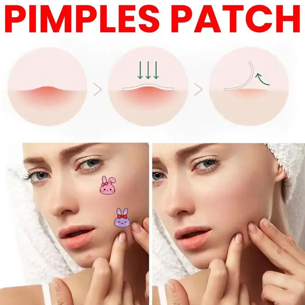 Cartoon Bunny Pimple Patches | Invisible Acne Spot Stickers Acne Pimple Patches QXL