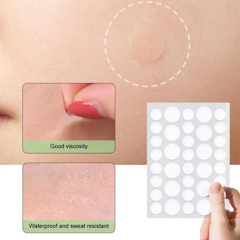 Hydrocolloid Pimple Patches with Tea Tree Oil | 72 or 288 Pack Acne Pimple Patches QXL