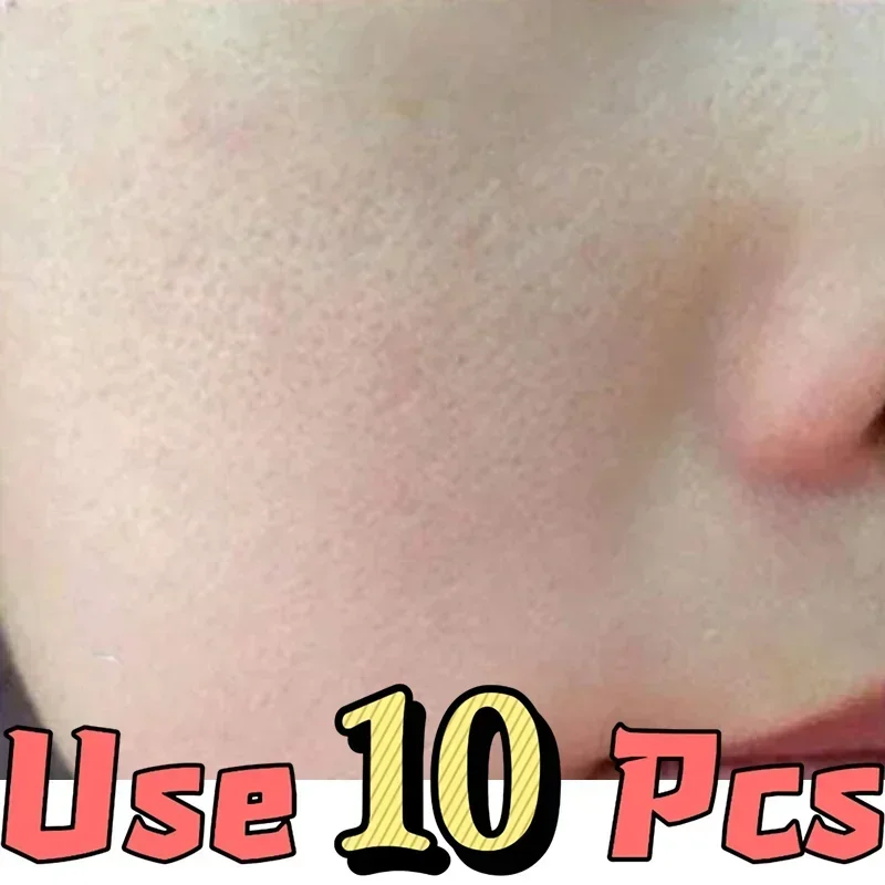 Pore-Minimizing Serum | Oil Control & Brightening Face Gel Face Serum QXL