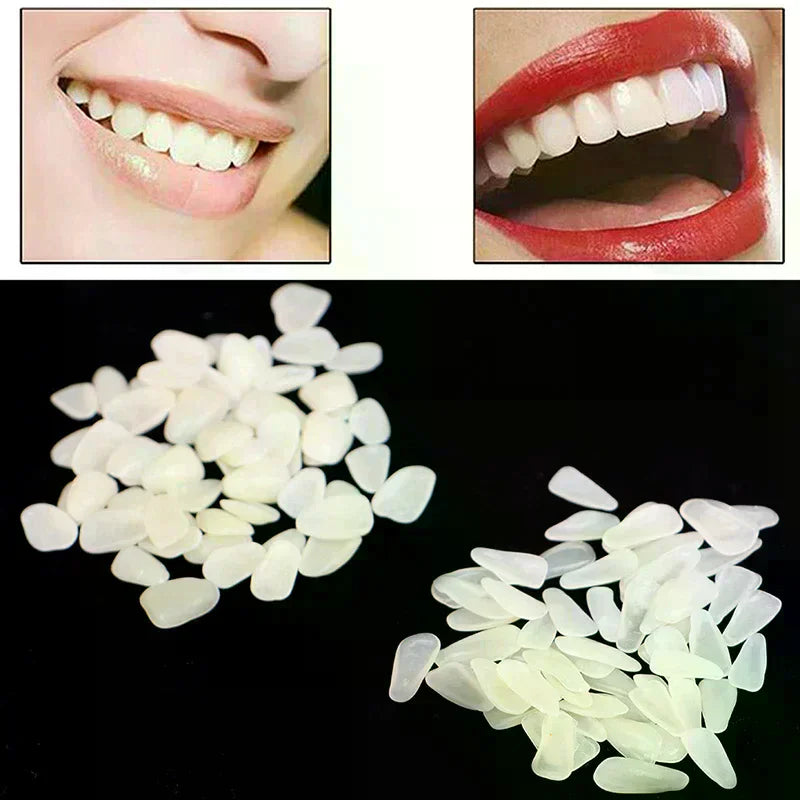 60-Pack Ultra-Thin Resin Temporary Dental Veneers | No Glue Temporary Dental Veneers QXL