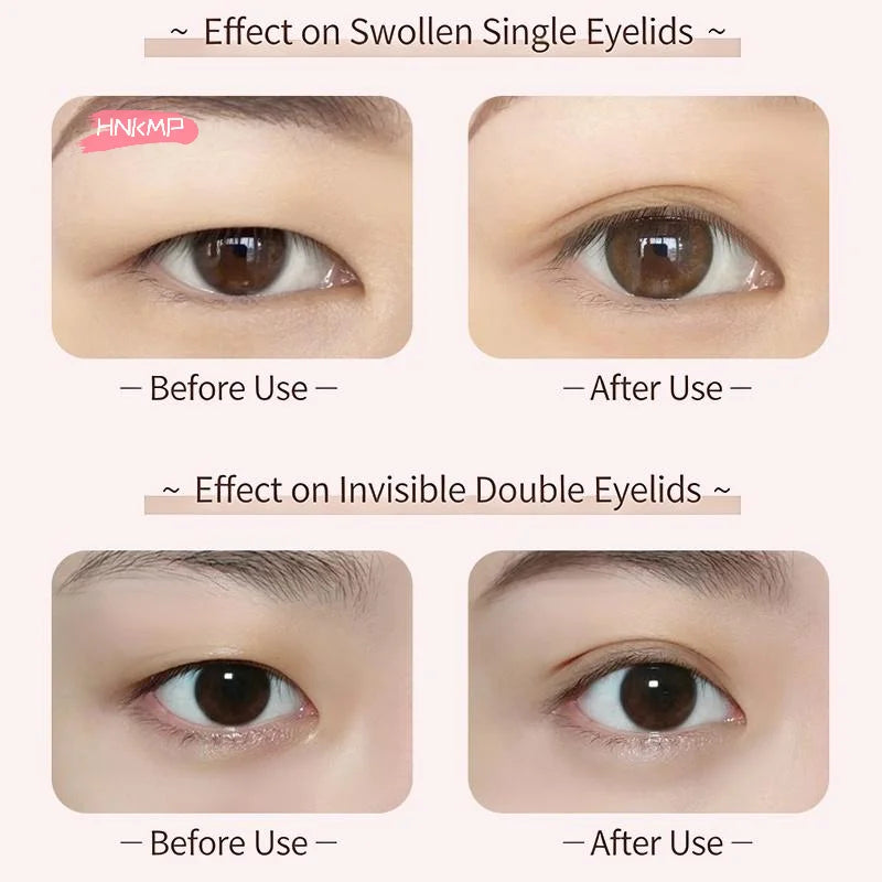 300-Pack Invisible Double Eyelid Tape Stickers | Big Eye Eyelid Shaping Tape QXL