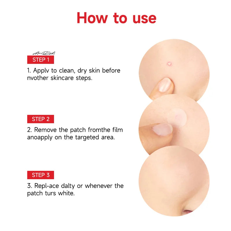 Invisible Hydrocolloid Blemish Patches 24/36-Pack | Clear Skin Blemish Patch QXL