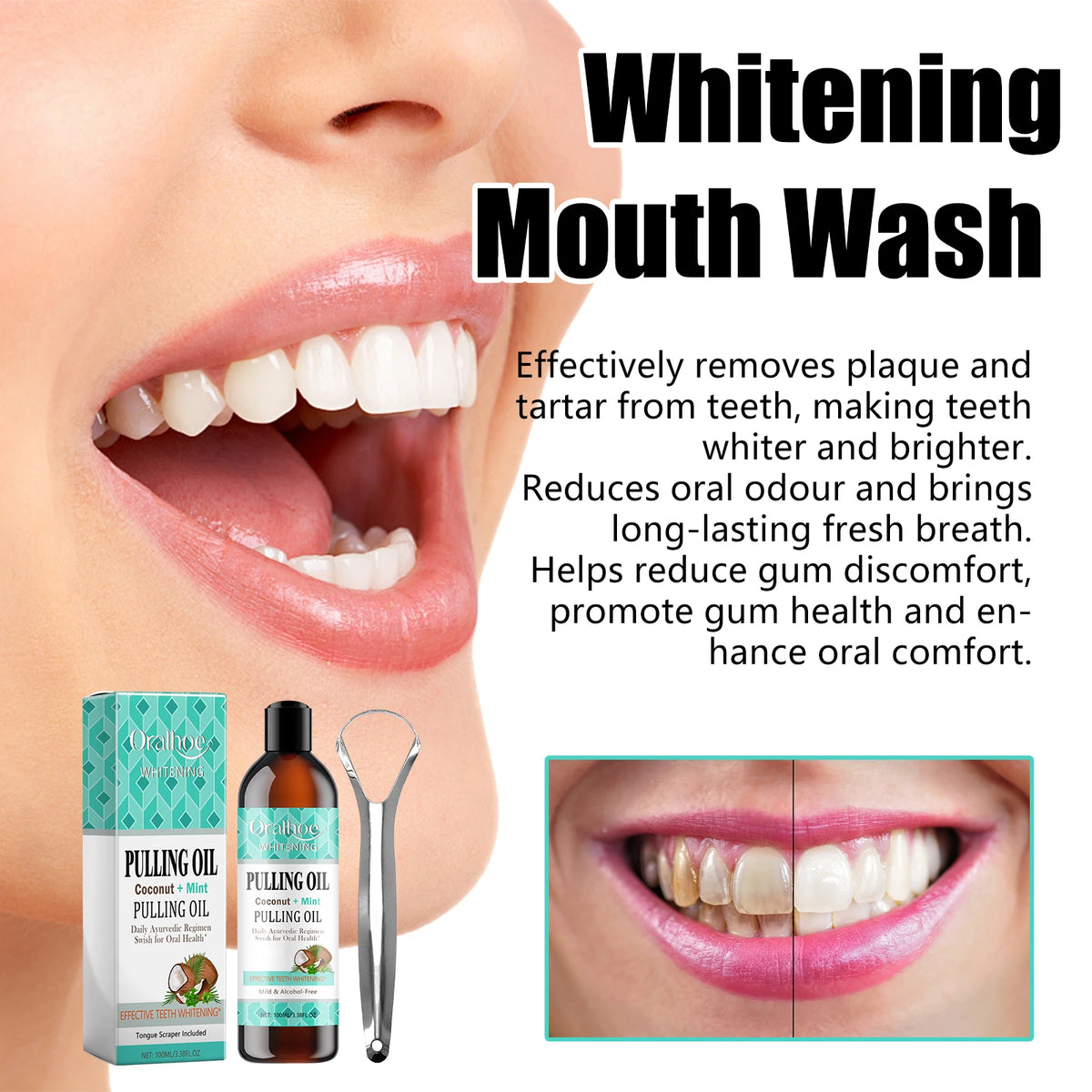 Coconut Mint Oil Pulling Mouthwash & Tongue Scraper Kit Oil Pulling Mouthwash QXL