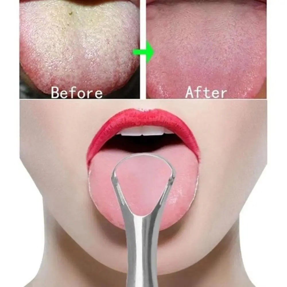 Stainless Steel Tongue Scraper | Fresh Breath Oral Care Tool Tongue Scraper QXL