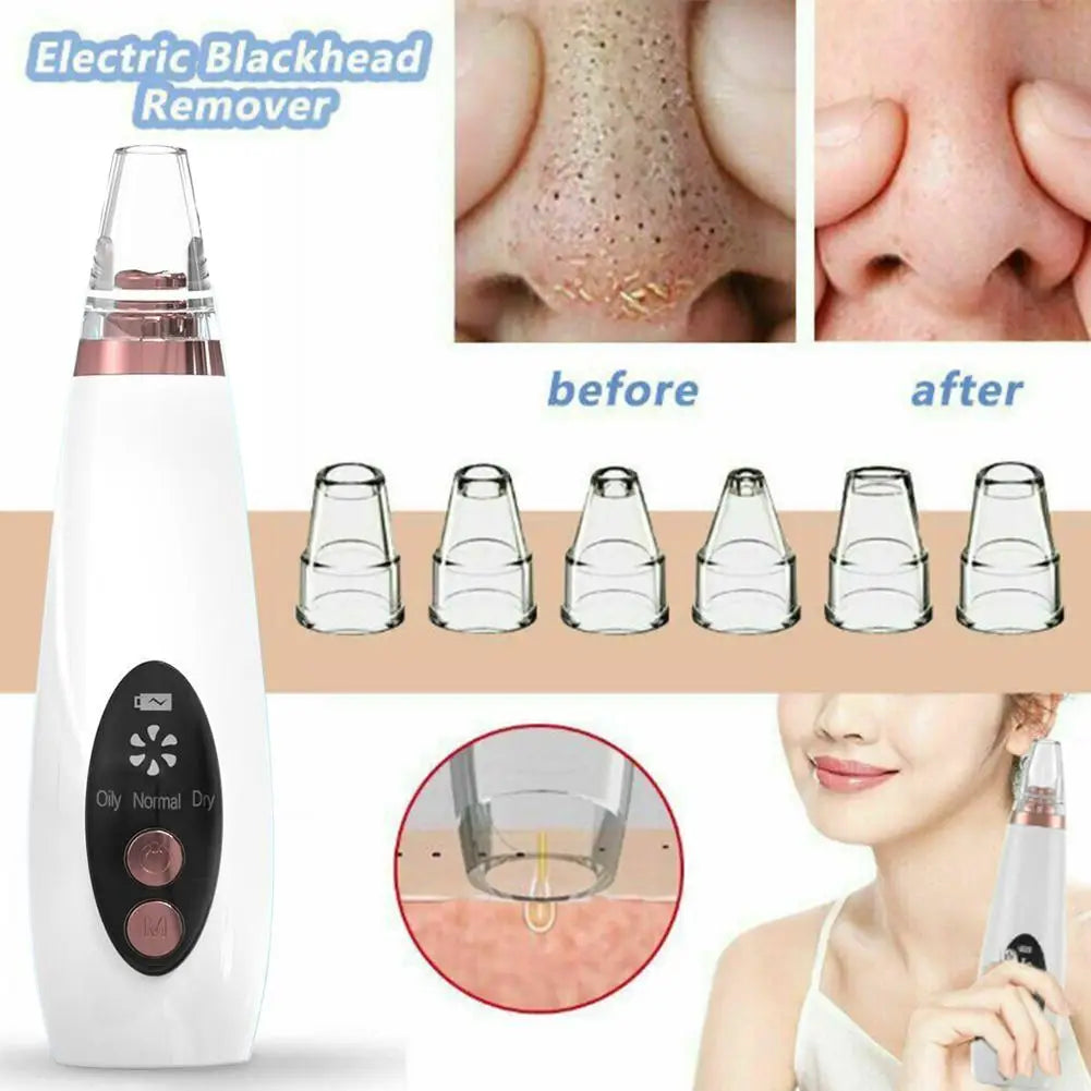 Electric Blackhead Remover | USB Rechargeable 3-Speed Pore Vacuum Pore Vacuum Cleanser QXL