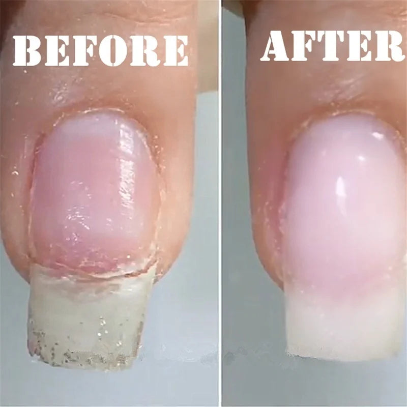 Fiberglass Silk Nail Extension Forms – UV Gel & Acrylic Wrap Nail Extension Forms QXL