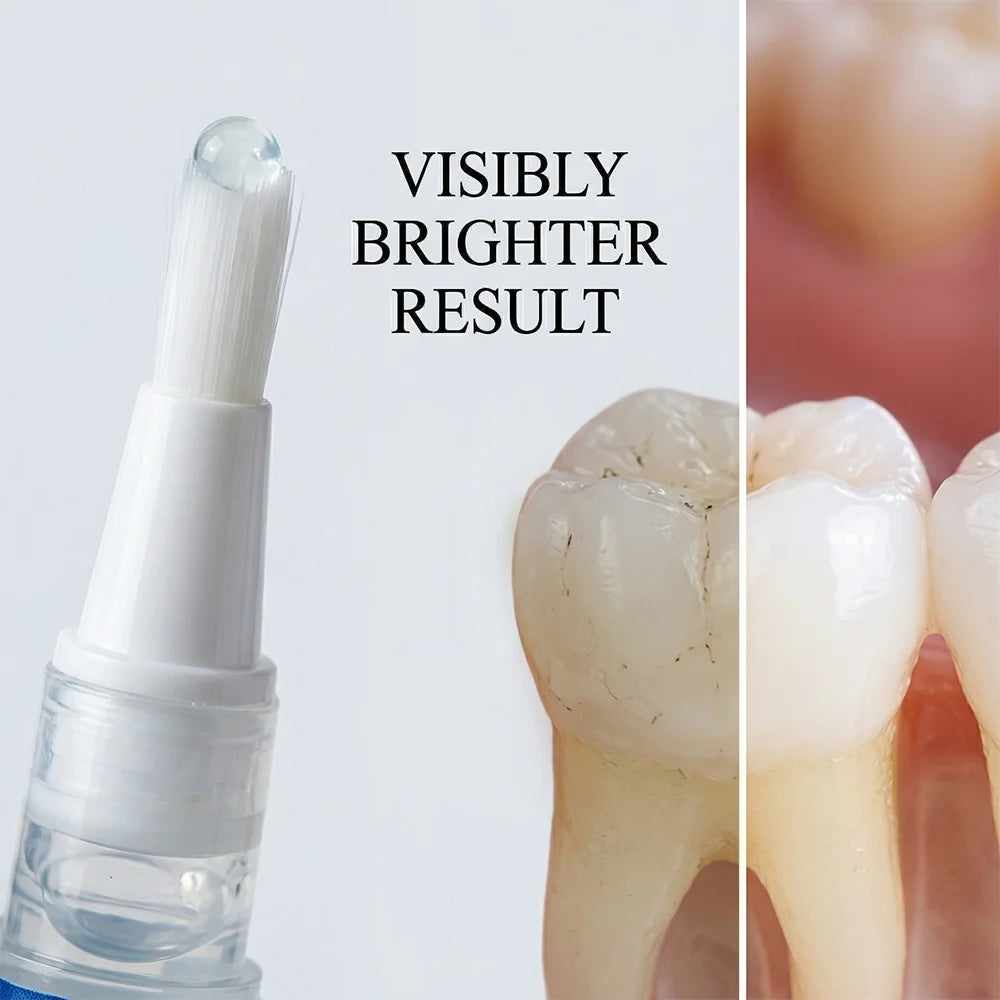 Teeth Whitening Pen | Stain & Plaque Removal Serum Gel Teeth Whitening Pen QXL