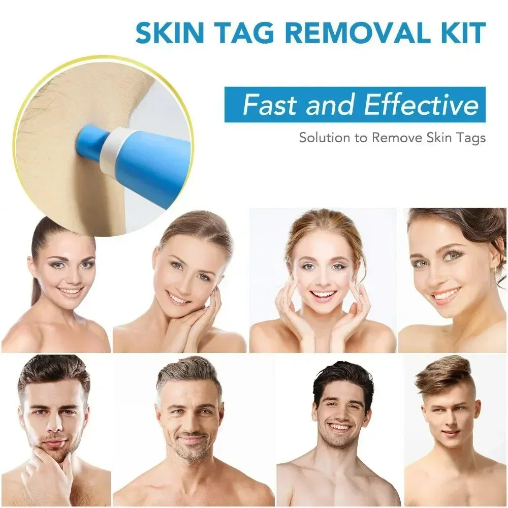 2-in-1 Dual Head Skin Tag & Wart Removal Pen Kit + Swabs Skin Tag Remover QXL
