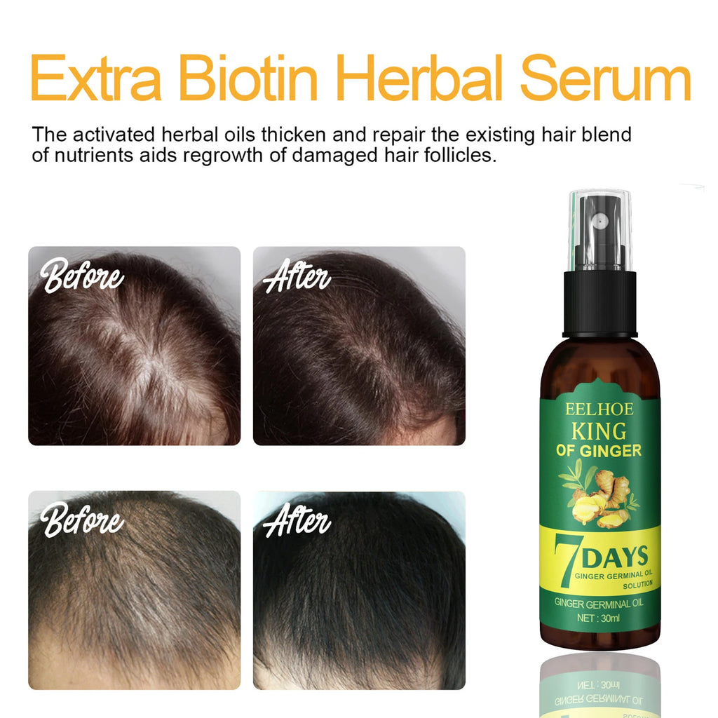 Ginger Root Hair Serum Spray | Scalp Nourish & Strengthen Hair Scalp Serum QXL