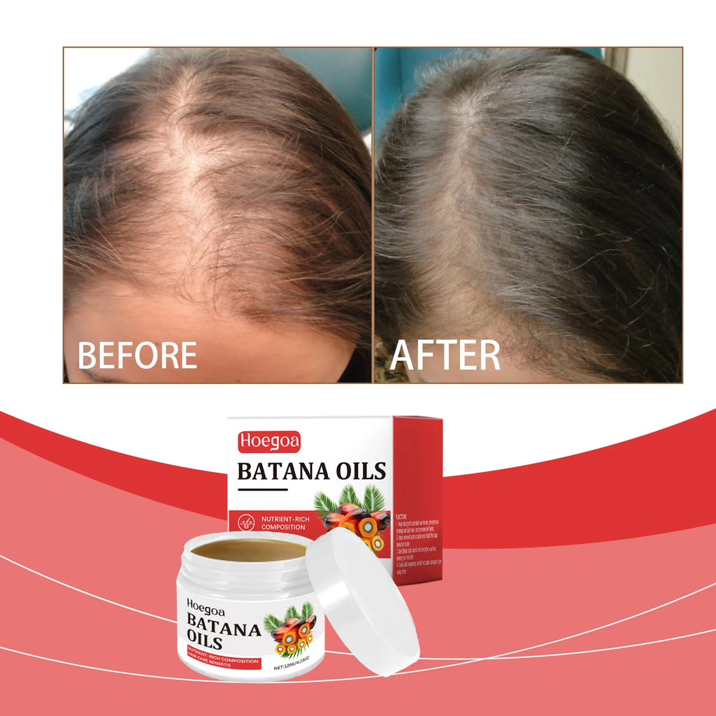 HOEGOA Batana Hair Oil | Organic Hair Mask – 120g Hair Treatment Oil QXL