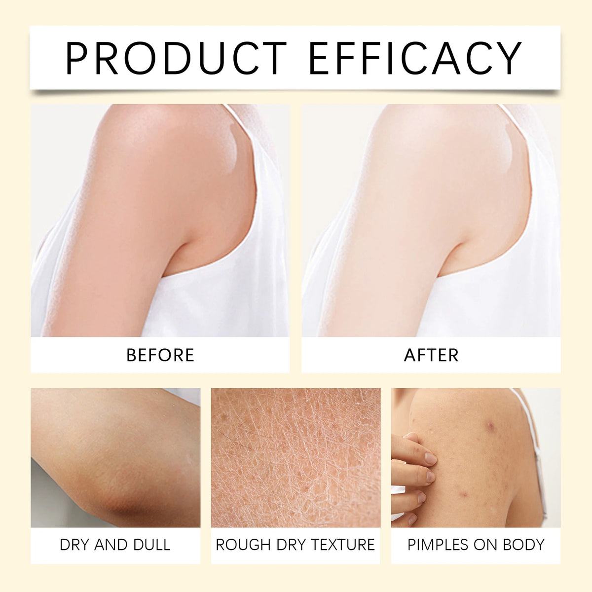 OceAura Bee Venom Body Cream | Brighten & Moisturize 100g Body Brightening Cream QXL