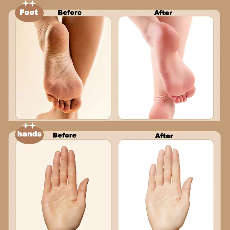 3-in-1 Rechargeable Electric Foot File & Callus Remover Electric Foot File QXL