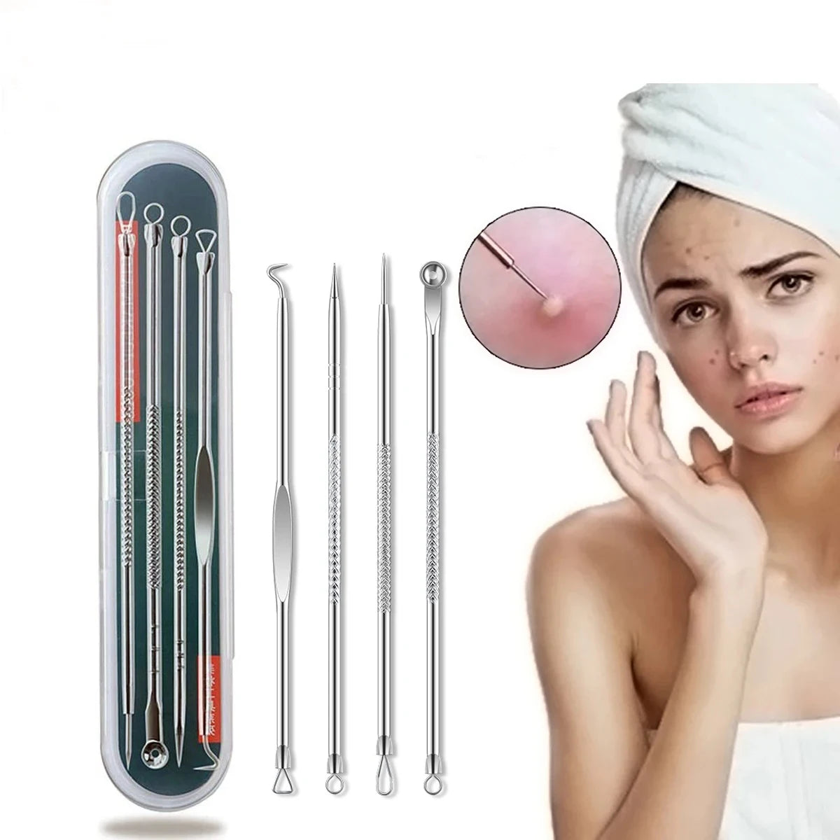 4-Piece Blackhead Extractor Tool Set | Stainless Steel Skin Care Blackhead Extractor Set QXL