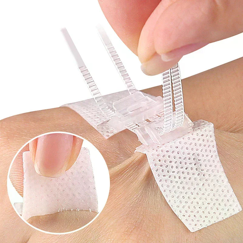 Zipper Wound Closure Patches | Suture-Free Bandage Strips Wound Closure Patch QXL