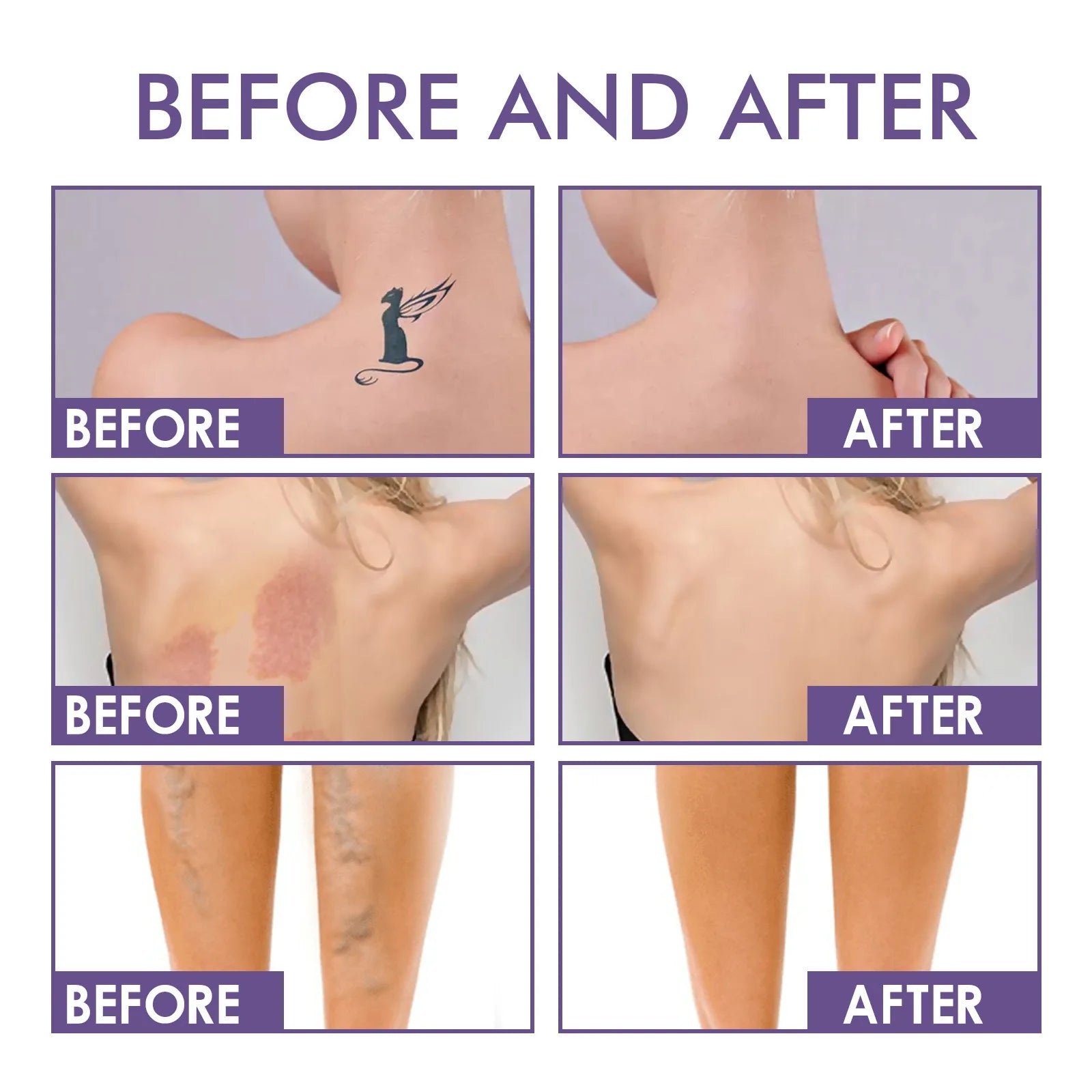 LUXURYTO Waterproof Body Concealer Cream | Spots & Tattoos Body Concealer Cream QXL