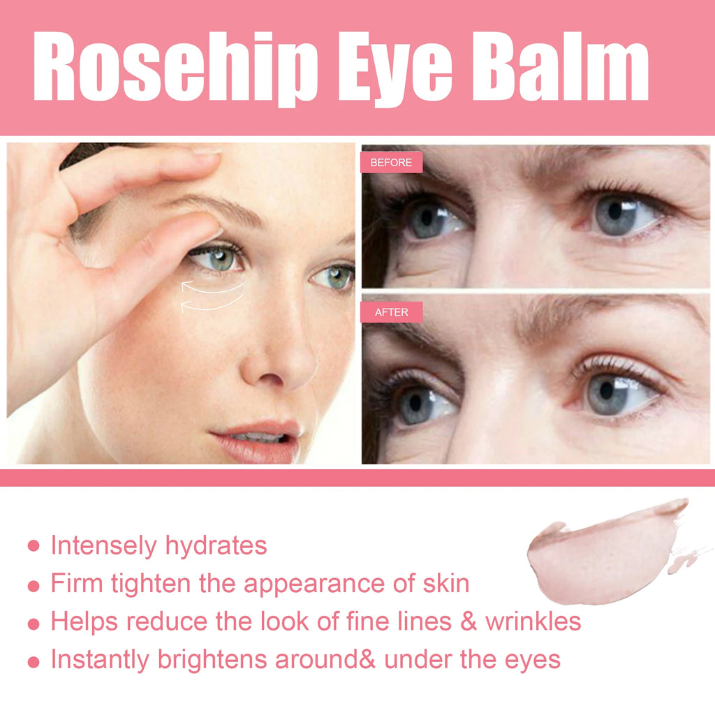 WEST MONTH Rosehip Eye Balm Stick – Hydrating & Firming Eye Balm Stick QXL