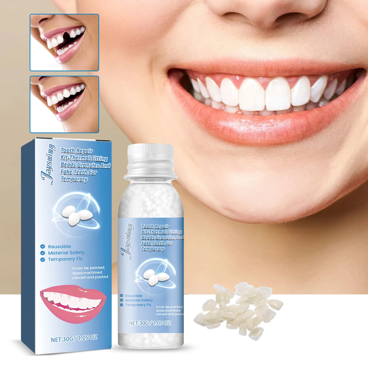 30g Moldable Temporary Tooth Repair Kit | Solid Gel Adhesive Tooth Repair Gel QXL
