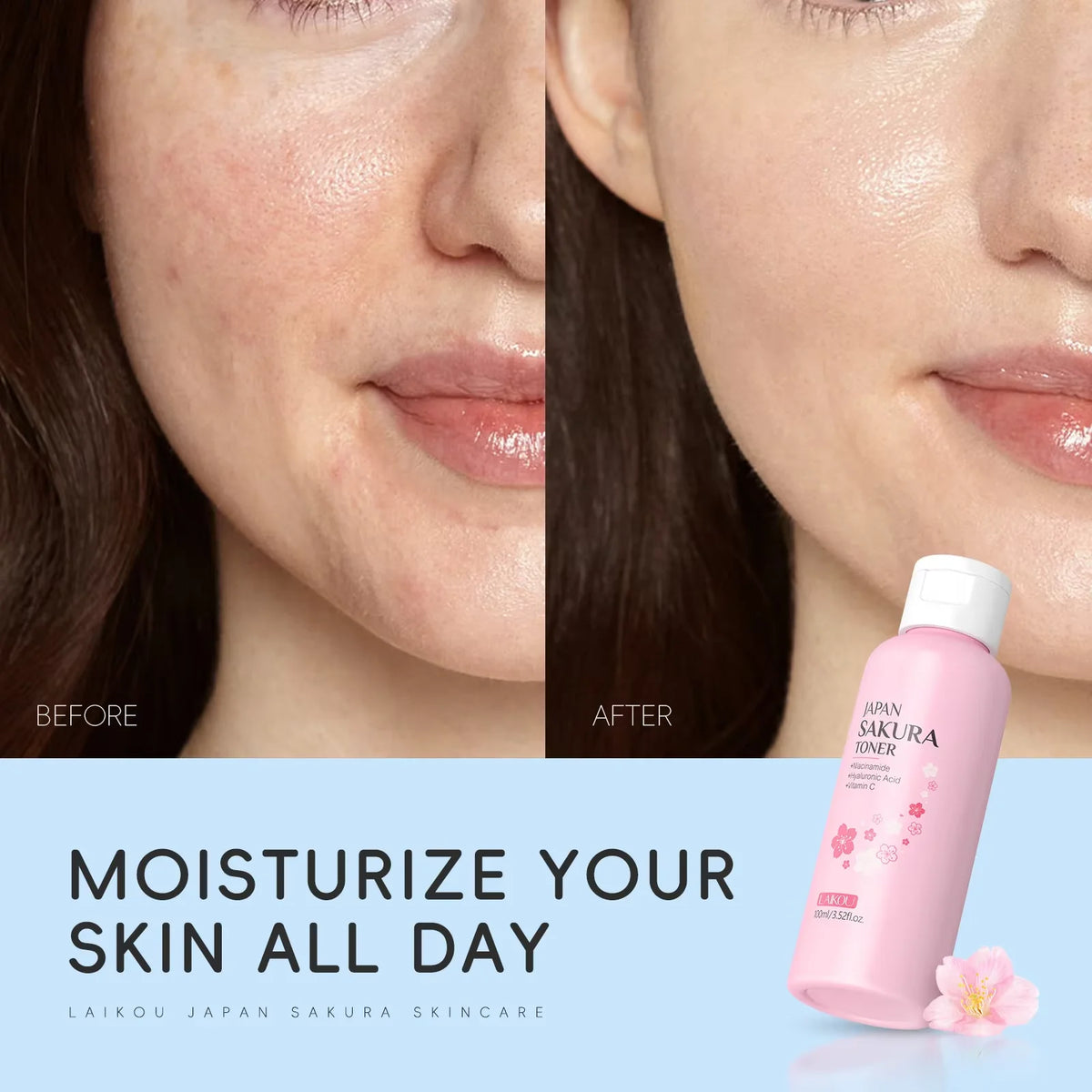 Laikou Sakura Hydrating Toner 100ml – Brightening & Oil Control Facial Toner QXL