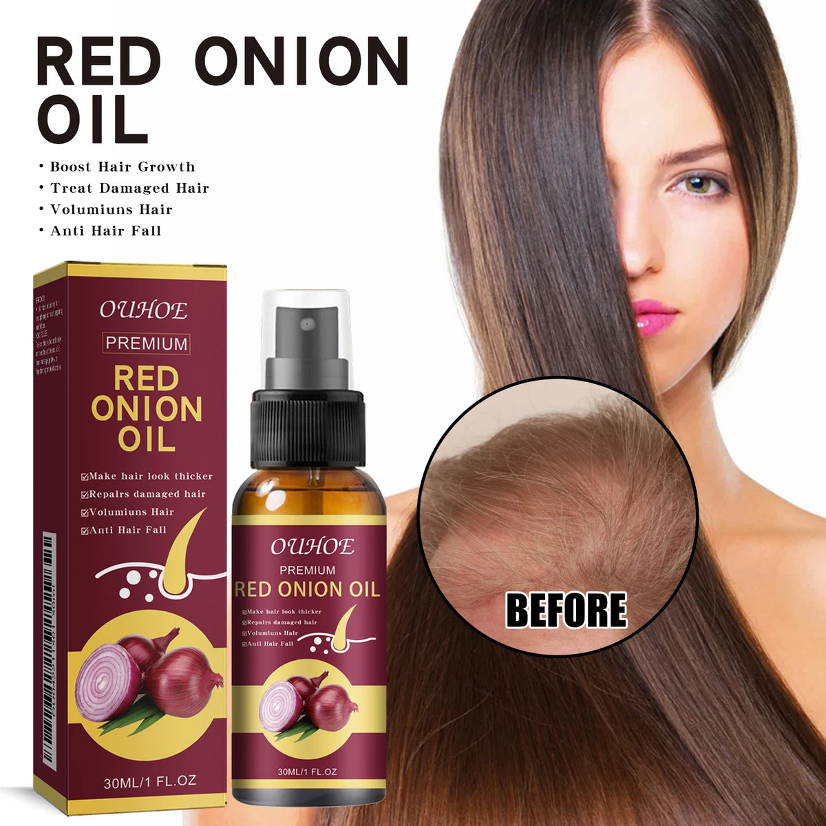 Red Onion Hair Growth Spray – Nourish Roots & Strengthen Hair Hair Growth Spray QXL