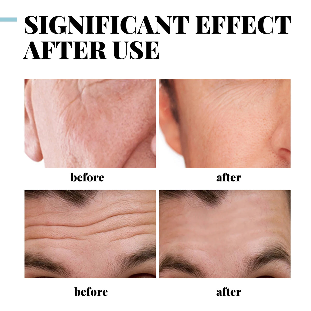 Eelhoe Men's Retinol Collagen Anti-Wrinkle Face Cream 30/50g Men's Face Cream QXL