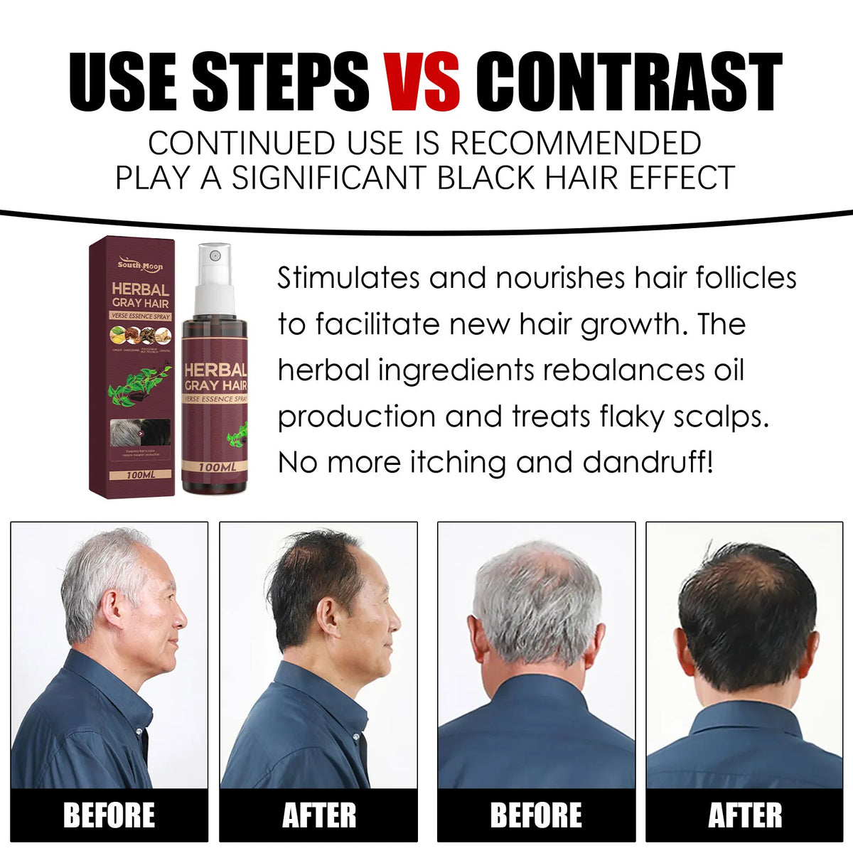 Herbal Black Hair Tonic Spray | Polygonum & Ginseng 100ml Herbal Hair Tonic Spray QXL