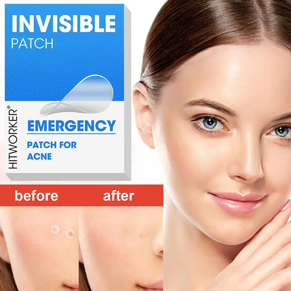 Hydrocolloid Acne Patches 400–1200 Pcs | Salicylic & Tea Tree Acne Patches QXL