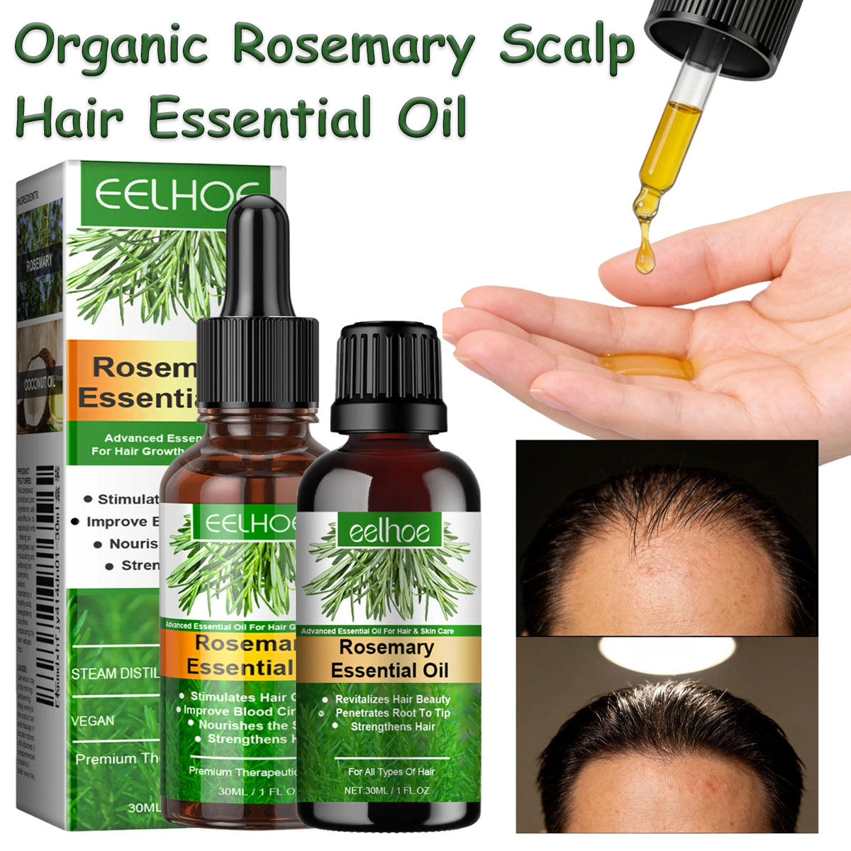 HOEGOA Rosemary Hair Oil – Shine, Frizz Control & Scalp Care Hair Essential Oil QXL