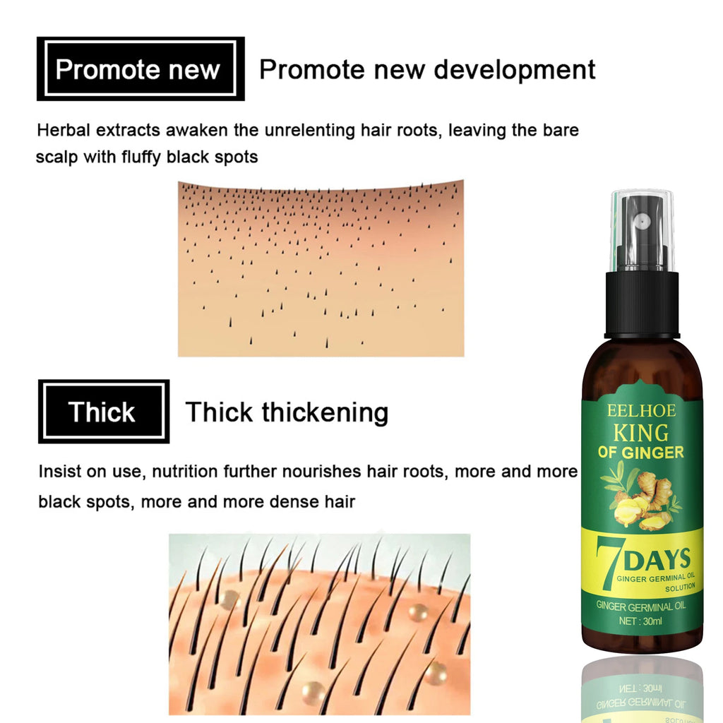 Ginger Root Hair Serum Spray | Scalp Nourish & Strengthen Hair Scalp Serum QXL
