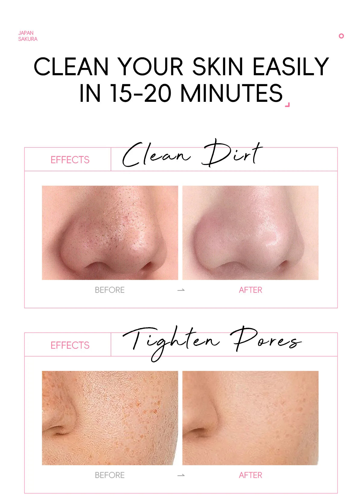 LAIKOU Cherry Blossom Peel-Off Mask | Hydrating & Brightening Peel-Off Face Mask QXL