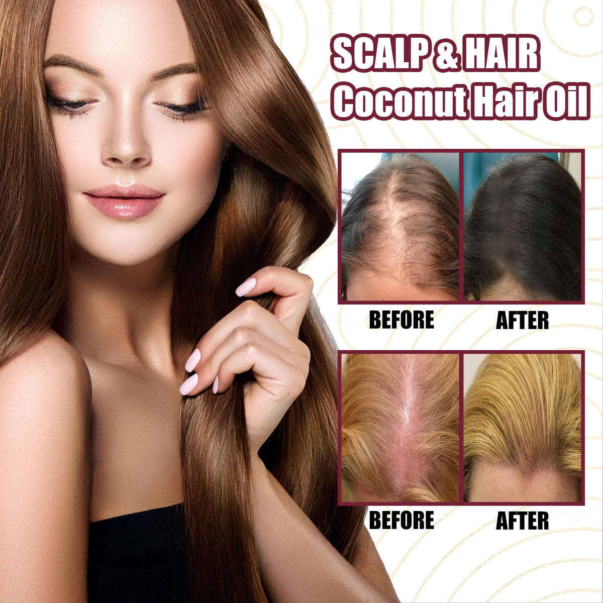 Red Onion Hair Growth Spray – Nourish Roots & Strengthen Hair Hair Growth Spray QXL