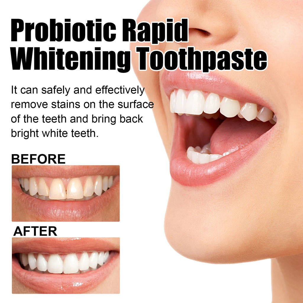 Eelhoe Xylitol Probiotic Whitening Toothpaste 120g Whitening Toothpaste QXL