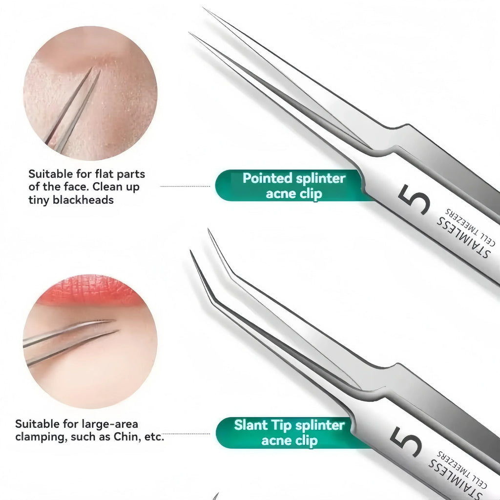 8-Pc Stainless Steel Blackhead & Acne Extractor Tool Kit Acne Extractor Kit QXL