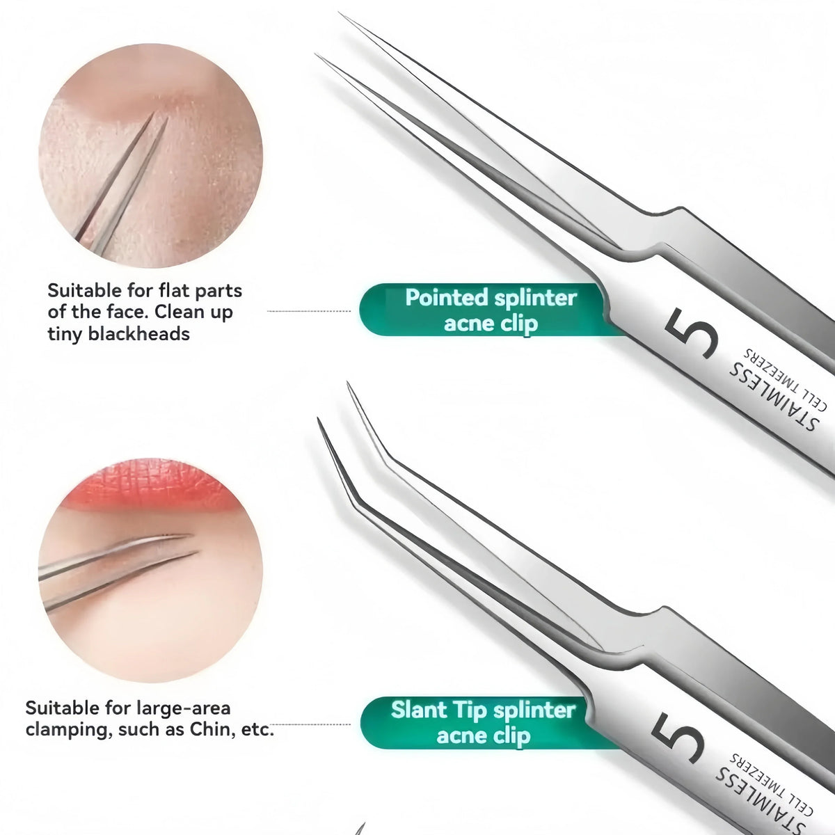 8-Piece Stainless Steel Blackhead Extractor & Blemish Tool Kit Blackhead Extractor Kit QXL
