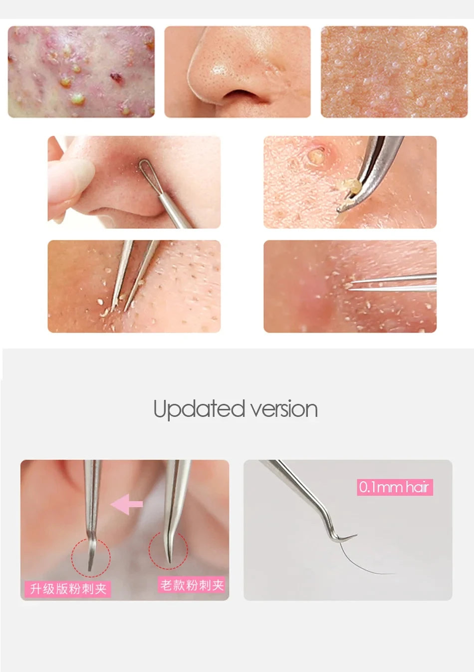 3-Piece Stainless Steel Facial Pore Cleansing Tool Set Pore Cleansing Tool Set QXL