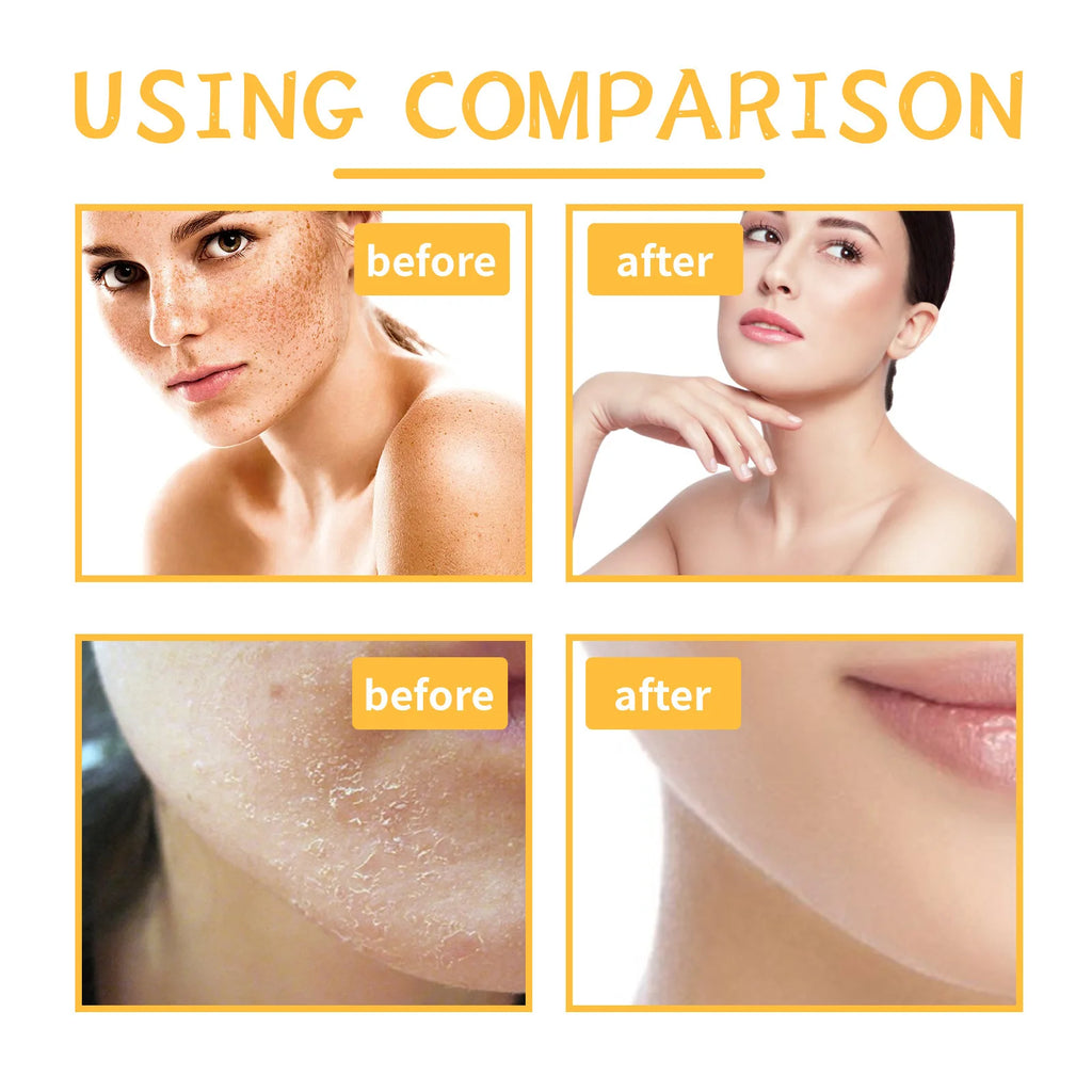 EELHOE Turmeric Body Scrub – Brightening & Moisturizing Body Scrub Exfoliator QXL