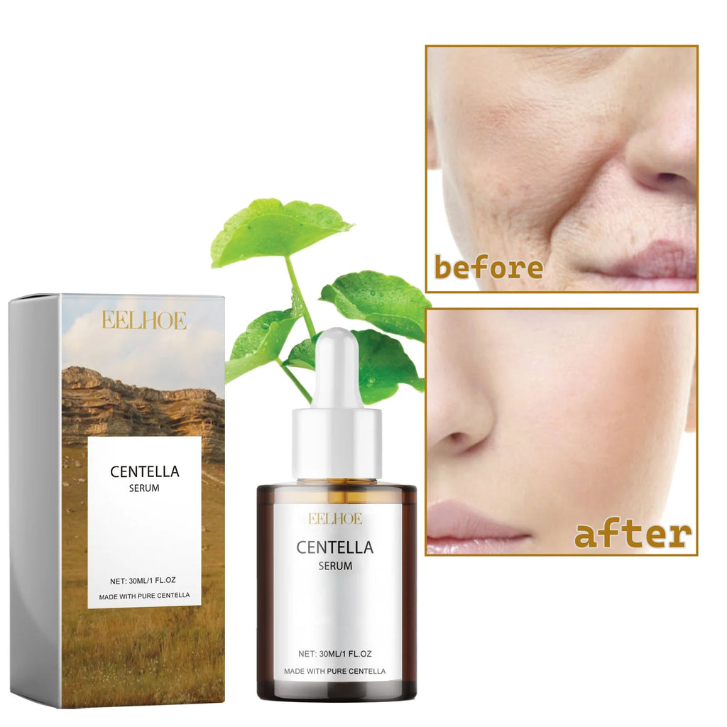 Pro Centella Face Essence – Deep Hydration & Smooth Skin Face Essence Serum QXL