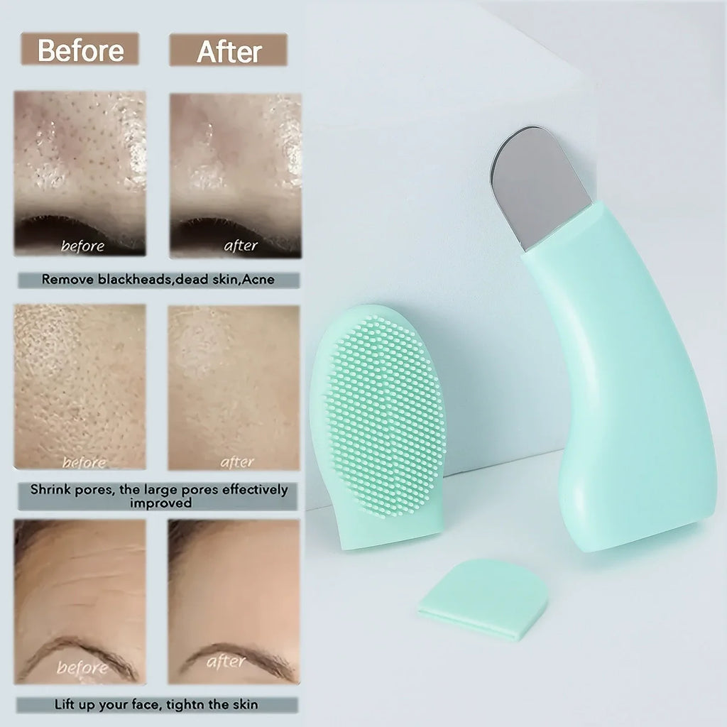 2-Pc Silicone Face Ice Roller & Blackhead Remover Set Face Ice Roller Set QXL