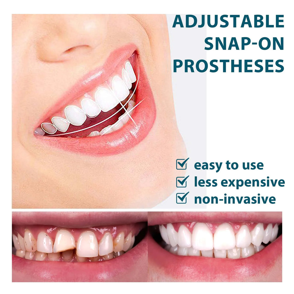 EELHOE Adjustable Snap-On Dentures | Gap-Fill Smile Kit Snap-On Dentures QXL