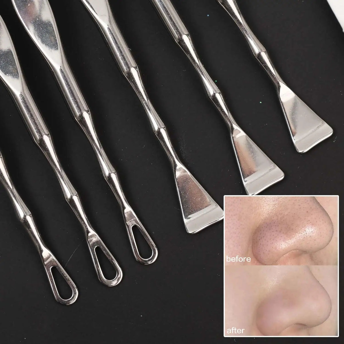 Double-Ended Stainless Steel Blackhead Extractor Tool Blackhead Extractor Tool QXL