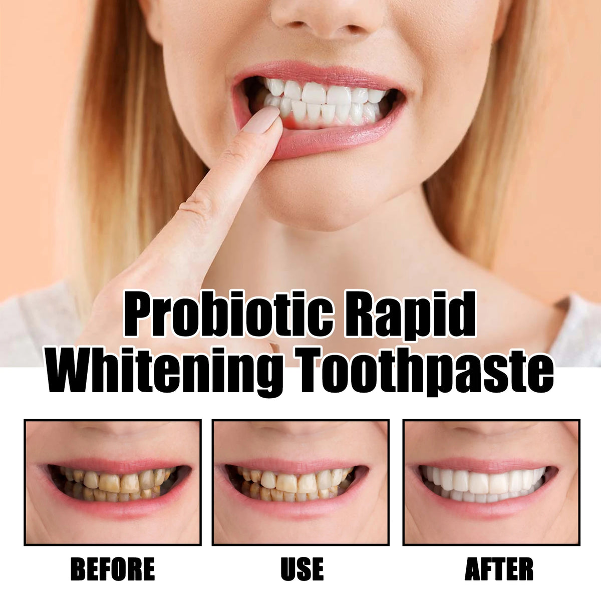Eelhoe Xylitol Probiotic Whitening Toothpaste 120g Whitening Toothpaste QXL