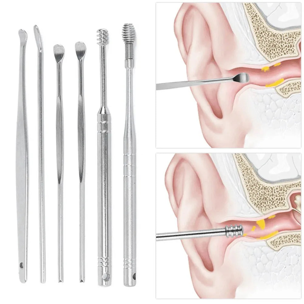6-Pc Stainless Steel Ear Wax Remover Kit | Multi-Tip Cleaner Ear Wax Remover Kit QXL