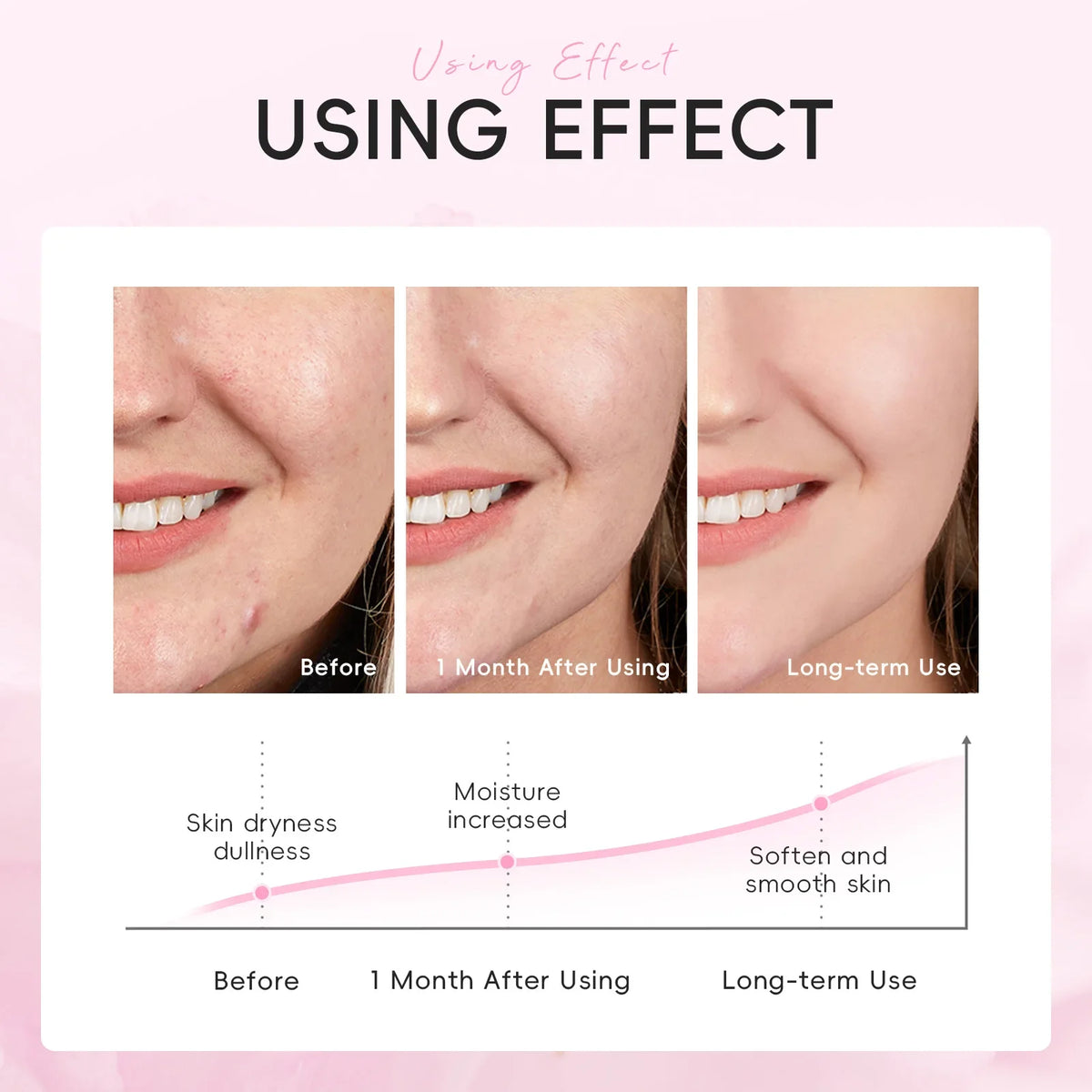 LAIKOU Japan Sakura Moisturizing Face Mask 10pcs | 25g Moisturizing Face Mask QXL