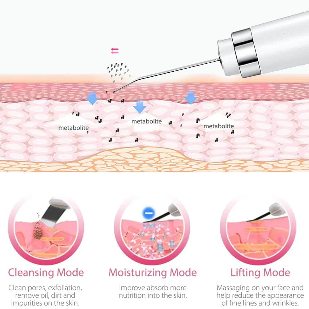 Ultrasonic Skin Scrubber | Deep Pore Cleansing Facial Device Ultrasonic Facial Scrubber QXL