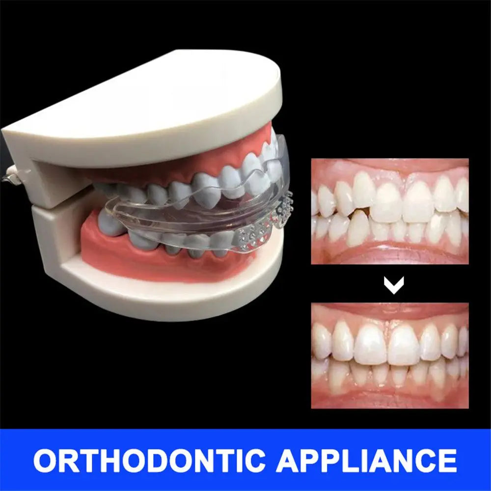 LONGPEAN 3-Stage Silicone Teeth Alignment Retainer Trainer Orthodontic Teeth Retainer QXL