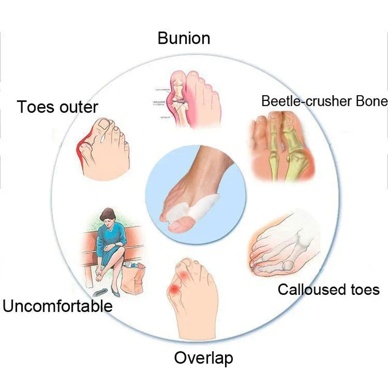 Silicone Gel Toe Separators & Spacers – 2-Pack Toe Protectors Toe Separator QXL