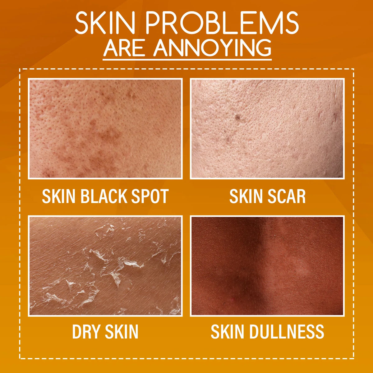 OUHOE Orange Peeling Lotion – Exfoliate & Brighten 100ml Exfoliating Body Lotion QXL