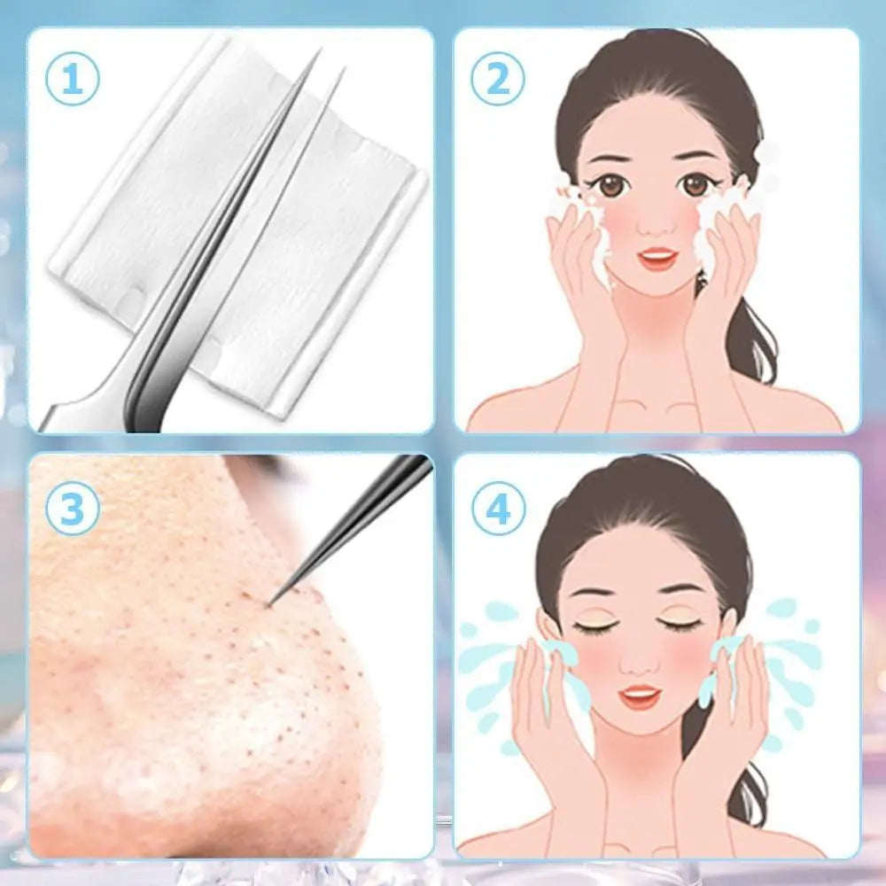 Stainless Steel Blackhead Extractor Tool Kit | Anti-Slip Blackhead Extractor Kit QXL